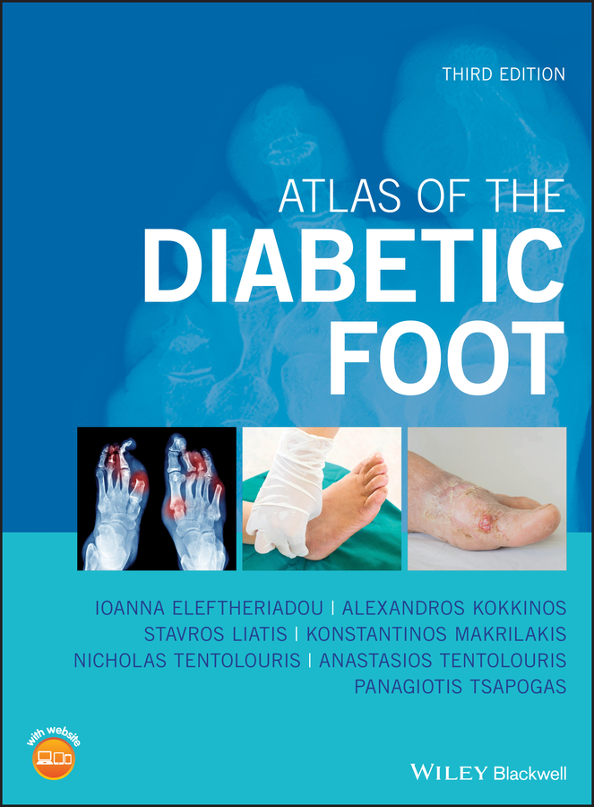 Panagiotis Tsapogas Atlas of the Diabetic Foot