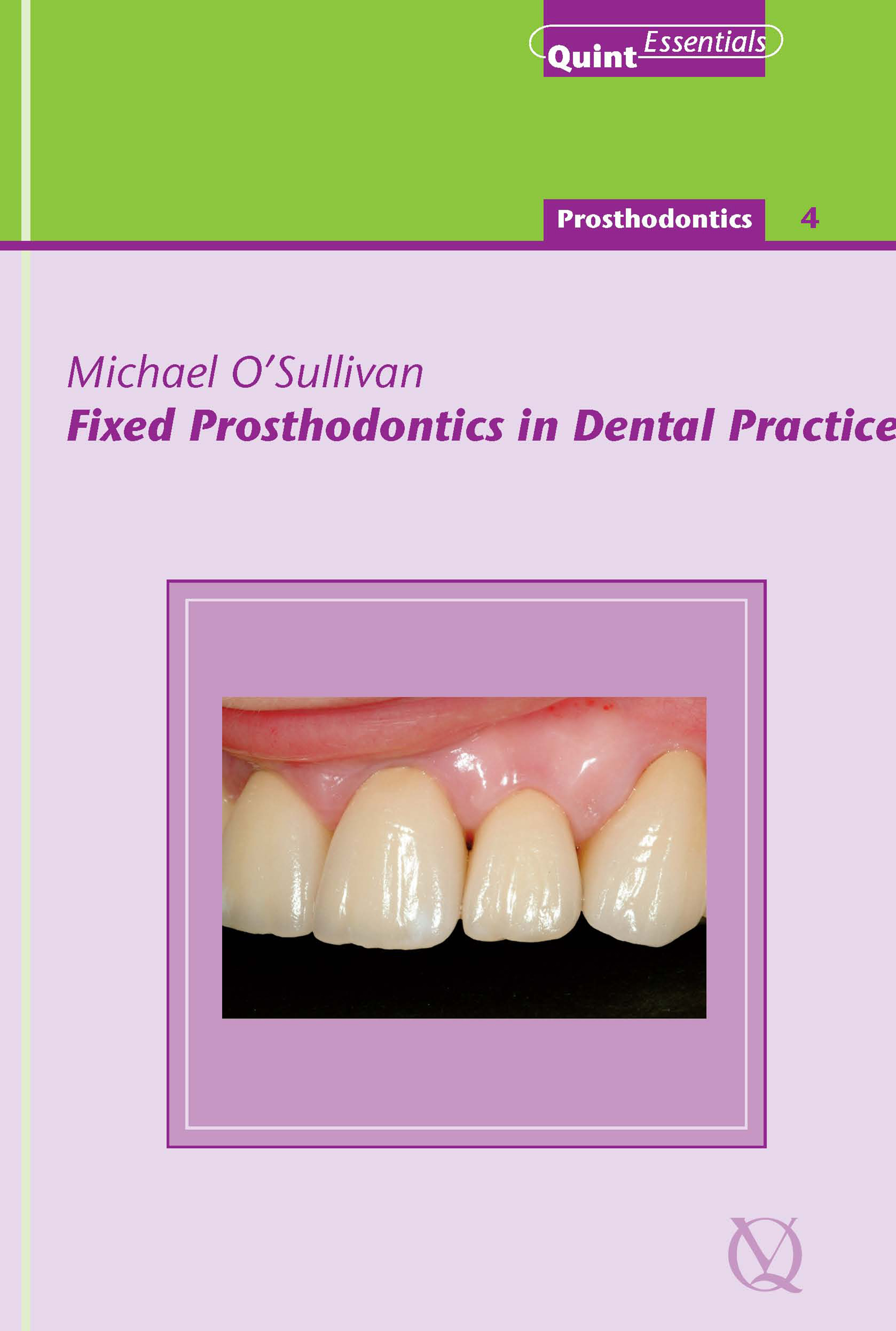 Fixed Prosthodontics in Dental Practice