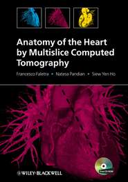 Anatomy of the Heart by Multislice Computed Tomography