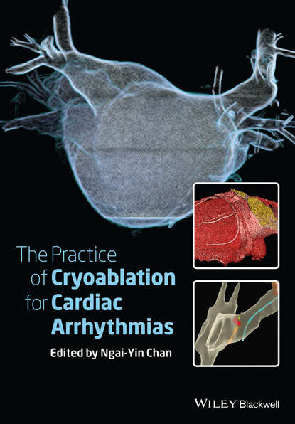 Ngai-Yin  Chan - The Practice of Catheter Cryoablation for Cardiac Arrhythmias