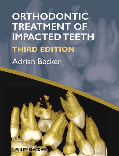 Orthodontic Treatment of Impacted Teeth - Adrian  Becker