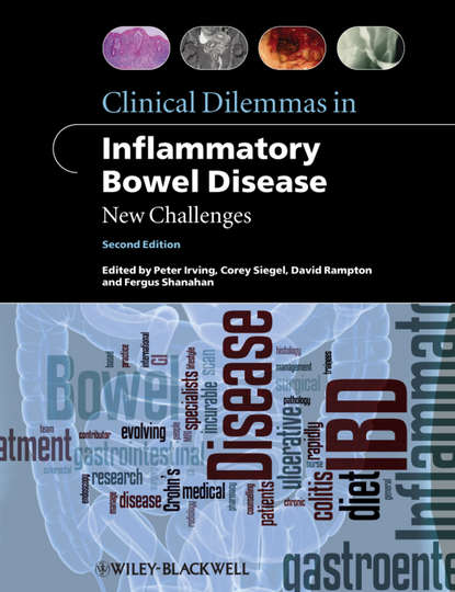 Clinical Dilemmas in Inflammatory Bowel Disease - Группа авторов