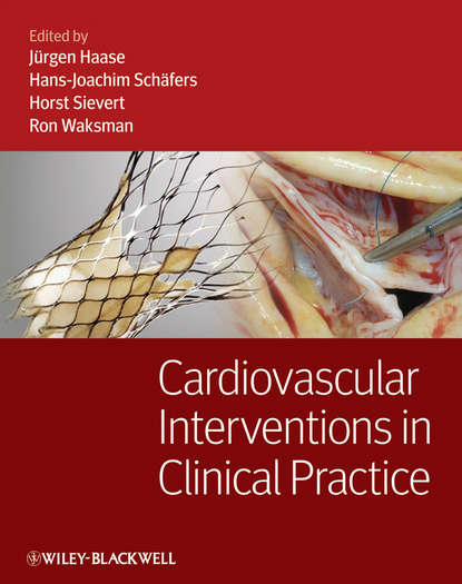 Cardiovascular Interventions in Clinical Practice - Группа авторов
