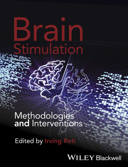 Brain Stimulation - Irving Reti