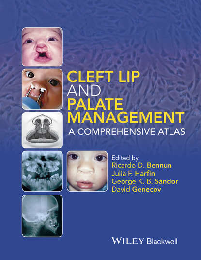 Cleft Lip and Palate Management - David Genecov