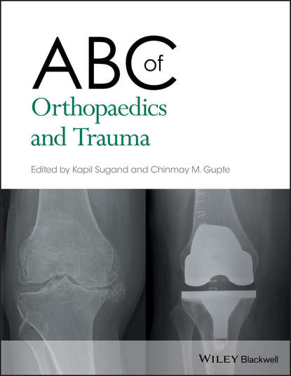 Kapil  Sugand - ABC of Orthopaedics and Trauma