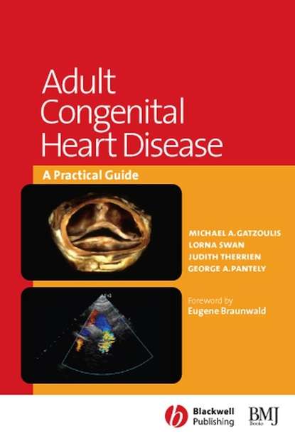Eugene  Braunwald - Adult Congenital Heart Disease