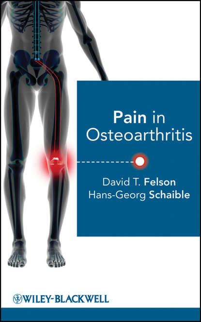 Hans-Georg  Schaible - Pain in Osteoarthritis