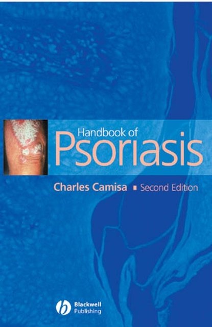 Группа авторов - Handbook of Psoriasis