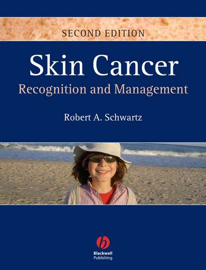 Skin Cancer - Группа авторов