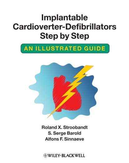 Roland Stroobandt X. - Implantable Cardioverter - Defibrillators Step by Step