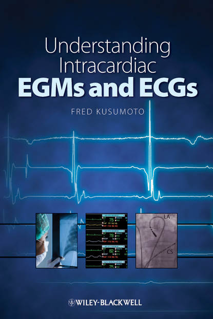 Группа авторов - Understanding Intracardiac EGMs and ECGs