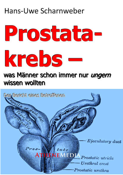 Prostatakrebs (Hans-Uwe  Scharnweber). 