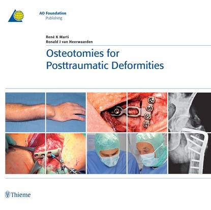 Ren K. Marti - Osteotomies for Posttraumatic Deformities