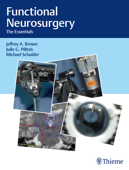 Jeffrey A. Brown - Functional Neurosurgery