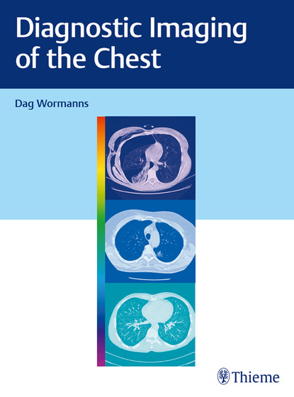 Dag Wormanns - Diagnostic Imaging of the Chest