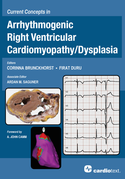 Группа авторов - Current Concepts in Arrhythmogenic Right Ventricular Cardiomyopathy/Dysplasia