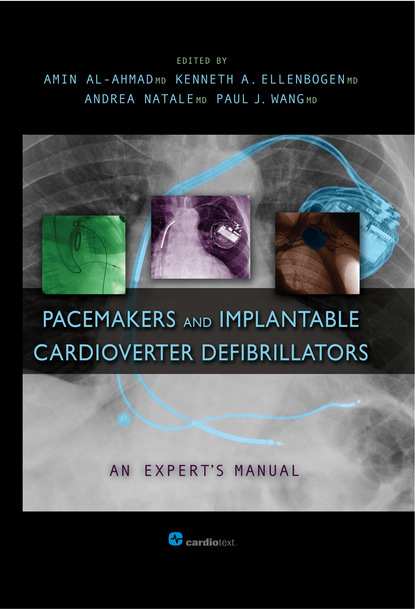 

Pacemakers and Implantable Cardioverter Defibrillators: An Expert's Manual