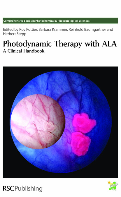 Группа авторов - Photodynamic Therapy with ALA