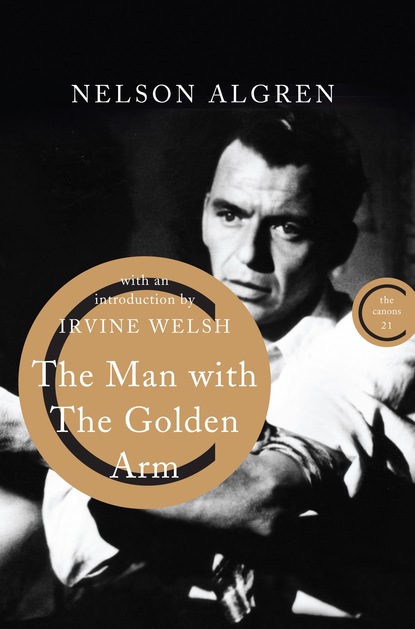 

The Man With the Golden Arm