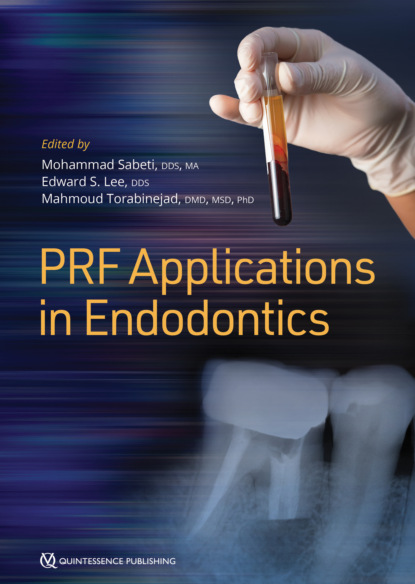 Mahmoud Torabinejad - PRF Applications in Endodontics