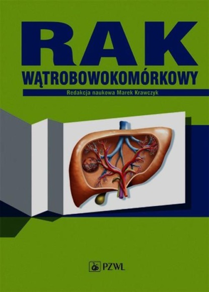 Группа авторов - Rak wątrobowokomórkowy