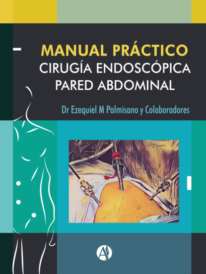 Ezequiel Mariano Palmisano - Manual Práctico de Cirugía Endoscópica de la Pared Abdominal