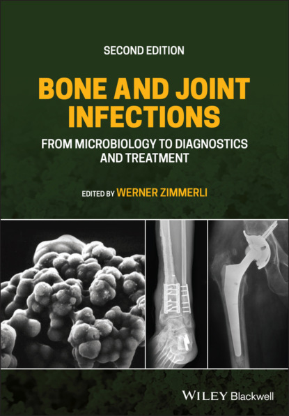 Группа авторов - Bone and Joint Infections