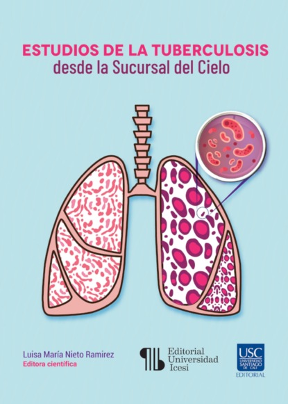 Luisa María Nieto Ramirez - Estudios de la tuberculosis desde la Sucursal del Cielo