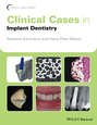 Clinical Cases in Implant Dentistry